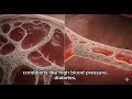 How Your Kidneys Work — And What Happens When They Fail#humananatomy #kidneyhealth