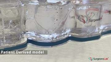 Revolutionizing Stroke Aspiration: Cutting-Edge Training & Technology Demonstration | SurgeonsLab