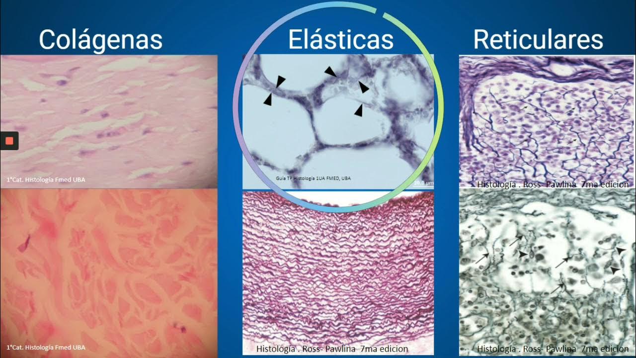 Matriz extracelular de TC YouTube