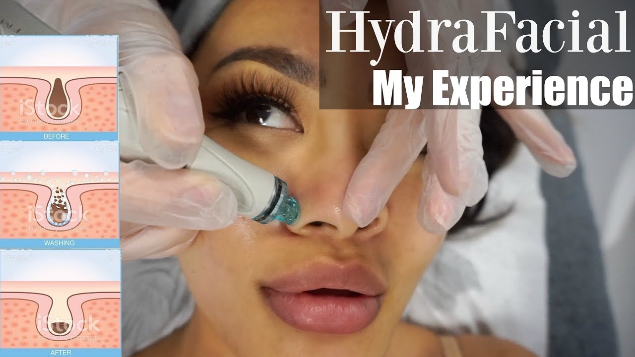 HydraFacial & Skin Analysis 🖤