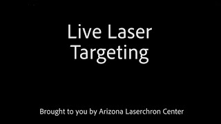 E2 and Nu - Live Laser Targeting