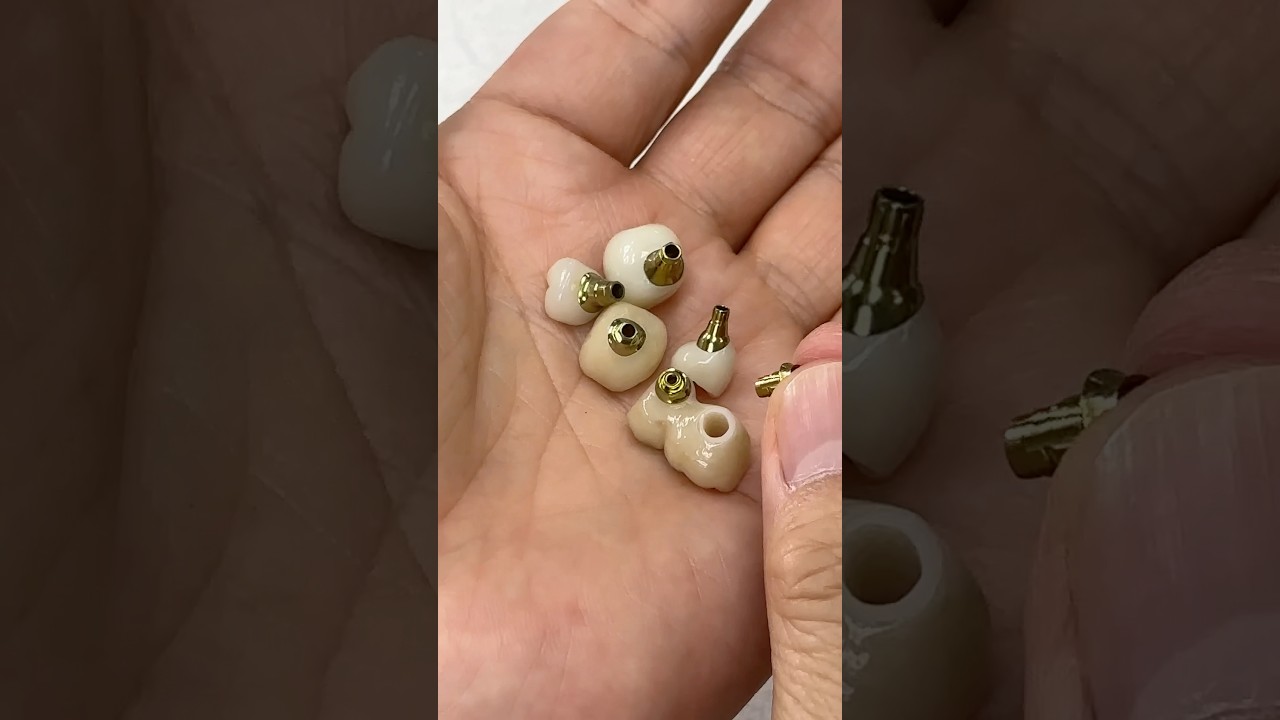 Ready to cement these Gold Titanium Abutments to Posterior Implants 