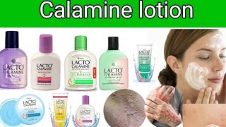 Calamine lotion |Best lotion for itching |Calamine lotion uses|Antifungal creams 