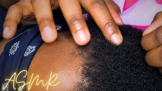 ASMR Scalp Check 🔍✨ | Satisfying Close-Up Head Inspection