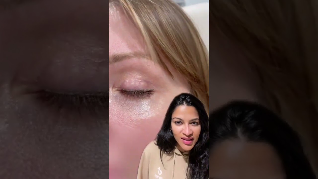 Eyelid Lift (Blepharoplasty) Incision Scar