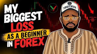 MY BIGGEST LOSS AS A BEGINNER IN FOREX TRADING#forextips #education #forextrading #60sectradingtruth