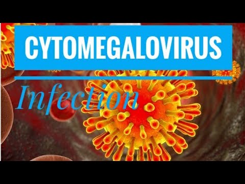 Video: Cyotmegalovirus - Behandling Af Cytomegalovirus Med Folkemedicin Og Metoder