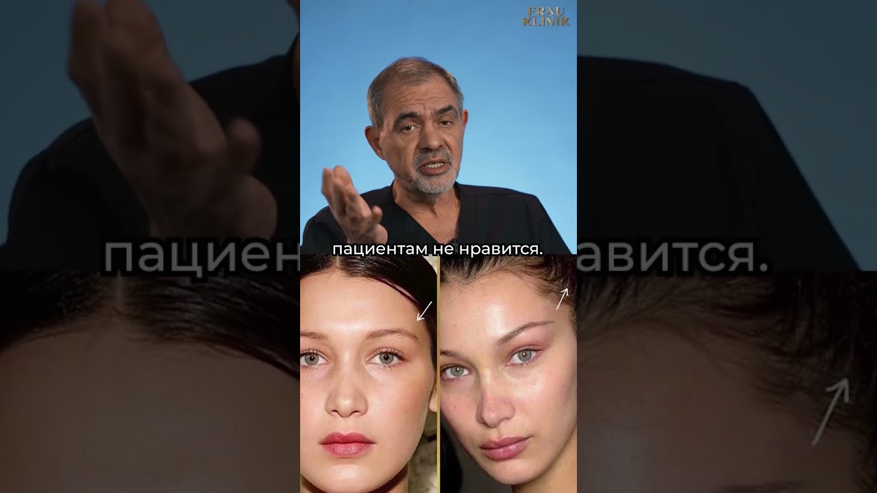 Чик-лифтинг. Что за операция? Какой результат? БЛОХИН С.Н.