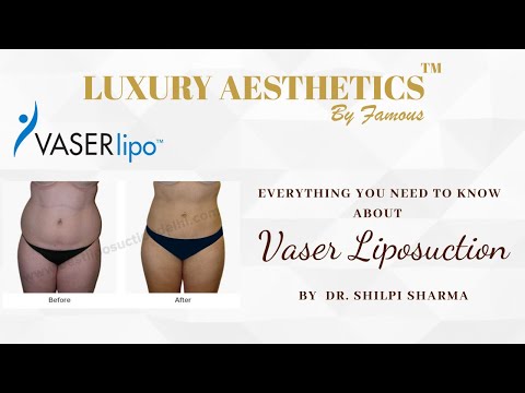 Everything You Need To Know About Vaser Liposuction | Luxury Aesthetics