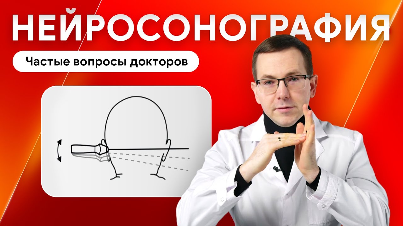 Нейросонография. Популярные вопросы по УЗИ головного мозга у детей