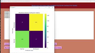 Monkey Pox Detection Using Modified VGG16 & Custom CNN