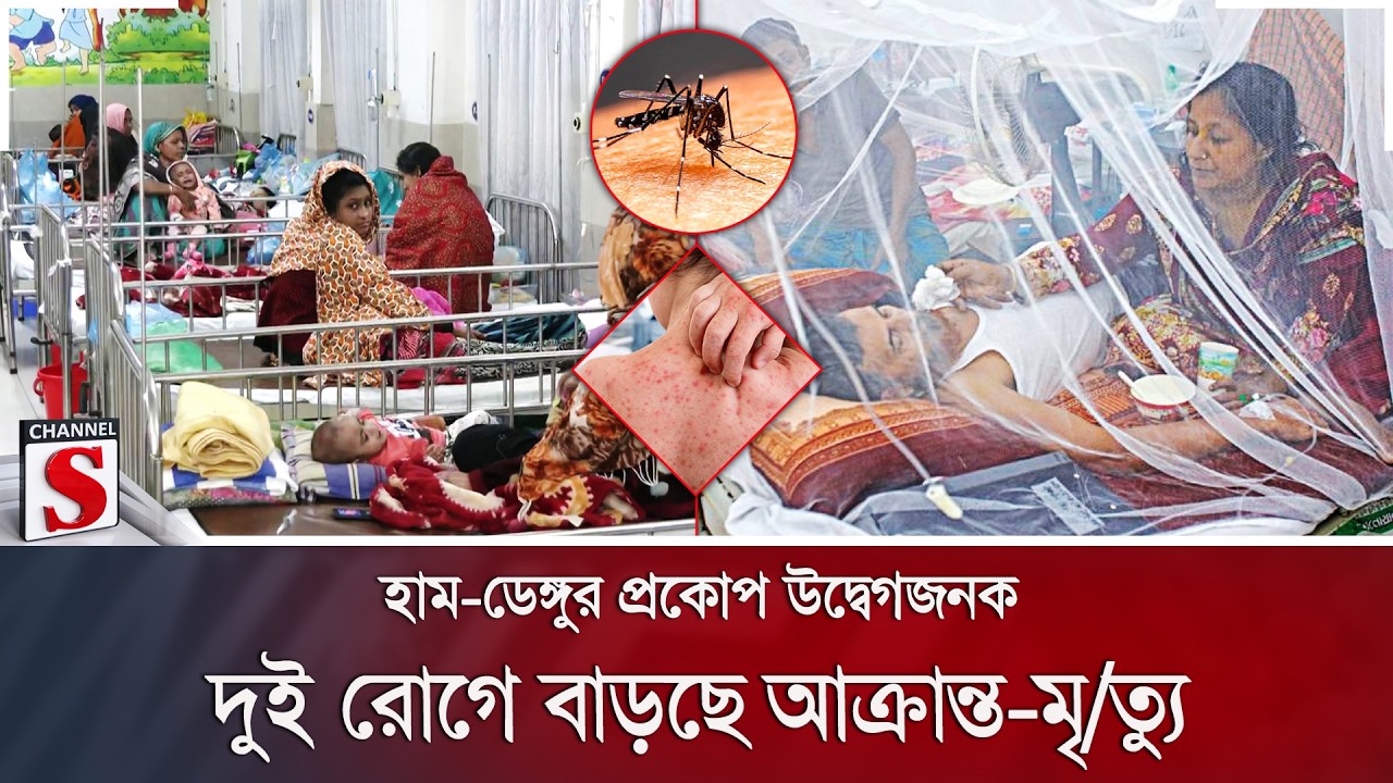 হাম-ডেঙ্গুর প্রকোপ উদ্বেগজনক; দুই রোগে বাড়ছে আক্রান্ত-মৃ/ত্যু | Measles | Dengue | Channel S News
