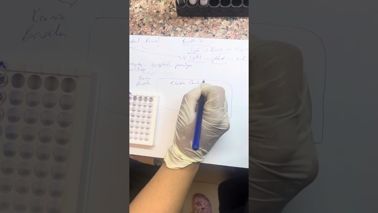 2-Merkaptoetanol-Rivanol Brucella tanısı(akut-Kronik)