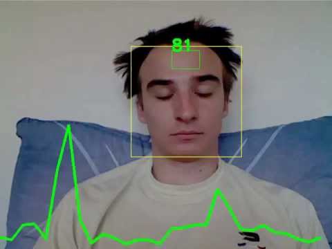 Heart-rate Monitor (Resting)