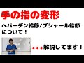 女性の指の変形「へバーデン結節／ブシャール結節」【解説：スポーツメディカル整骨院】
