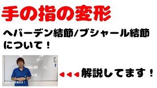 女性の指の変形「へバーデン結節／ブシャール結節」【解説：スポーツメディカル整骨院】