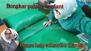 Bongkar Pasang Implant