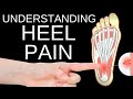 Why Plantar Fasciitis is Stubborn: How to Fix Heel Pain