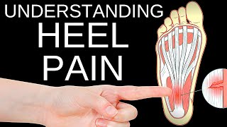 Simple Solutions to Fix Heel Pain (Plantar Fasciitis) and Foot Pain