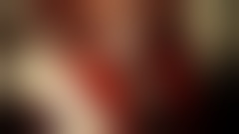 Unroofing of the Optic Canal