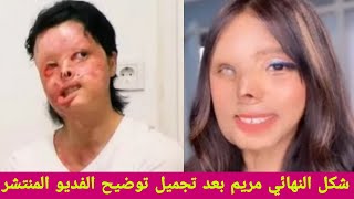 شكل النهائي الأميرة مريم بعد عملية تجميل شوفو شكله الجديد راح تنصدمون توضيح الفديو المنتشر