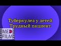 Туберкулез у детей. Трудный пациент © Tuberculosis in children (difficult patient)