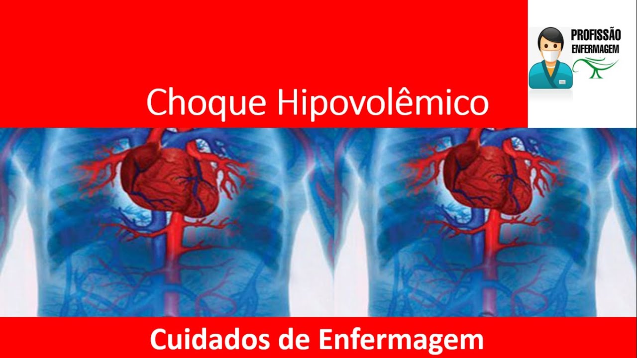 Choque Hipovolêmico Cuidados de Enfermagem no choque hipovolêmico