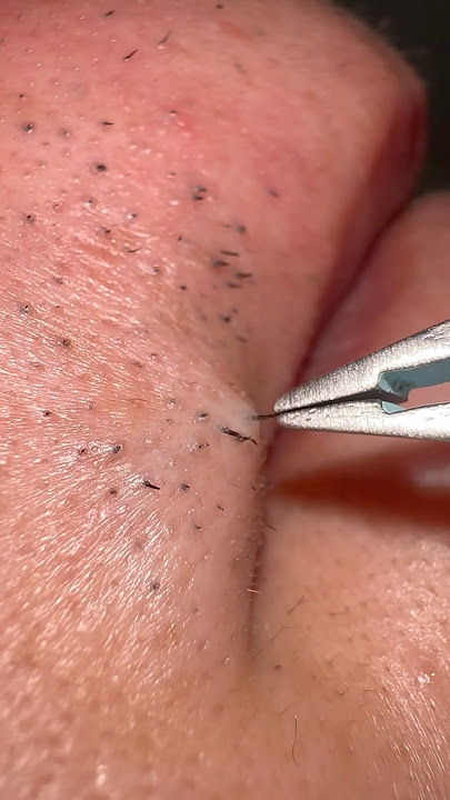 Calm Beard Grooming for a Peaceful Day #hairremoval #plucking #tweezers #routines #satisfying