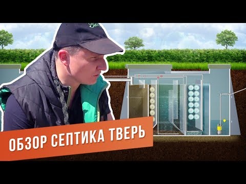 Бейне: Сізде жақсы септик бар-жоғын қалай білуге болады?