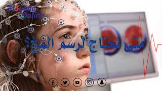 متى نلجأ لرسم المخ