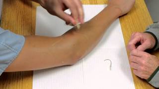 Scar Management
