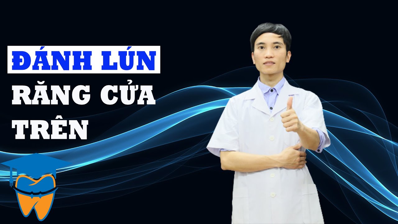 Bẻ Dây Cung Đánh Lún 4 Răng Cửa Hàm Trên - youtube