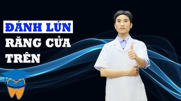 Bẻ Dây Cung Đánh Lún 4 Răng Cửa Hàm Trên