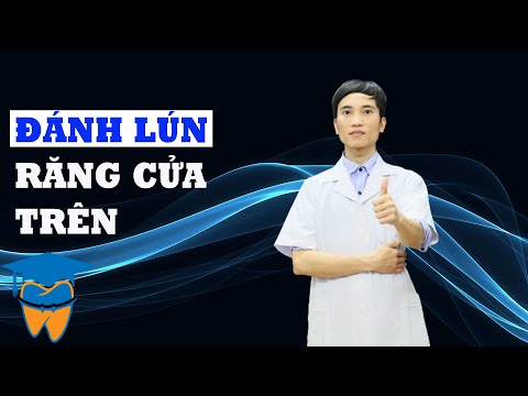 Video Bẻ Dây Cung Đánh Lún 4 Răng Cửa Hàm Trên - youtube