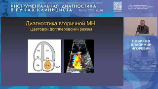 Вторичная митральная недостаточность. Новые диагностические потребности и лечебная тактика