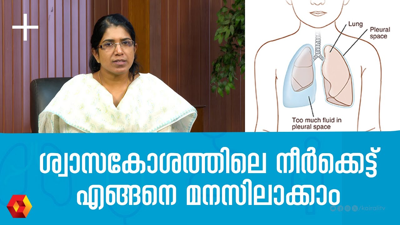 ശ്വാസകോശത്തിലെ നീർക്കെട്ട് ഏതു പ്രായത്തിലും ഉണ്ടാകാം | Pleural effusion | chest infection