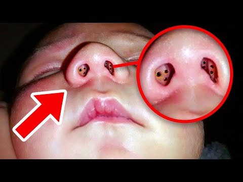 Video: Nemoci Kůže Na Nose U Psů