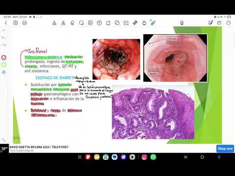 Patología Gastrointestinal