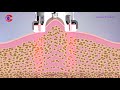 How Vacuum RF Fat Reduction Skin Tightening Treatment Work|Slimming Lymphatic Drainage Machine