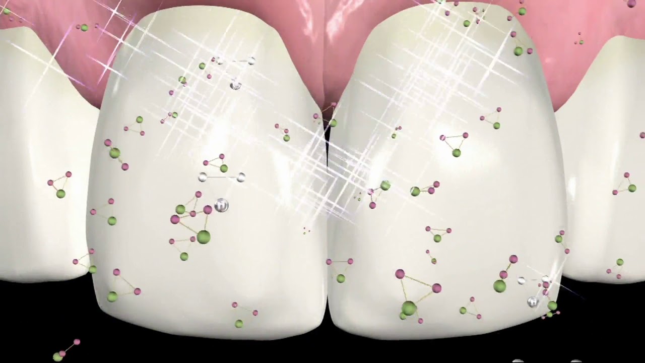 Supersmile Set of 3 TeethWhitening Quickee on QVC YouTube