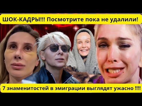 БЕЗ ДЕНЕГ И БЕЗ ЛИЦА: Как эмиграция уничтожила карьеру и внешность 7 российских знаменитостей