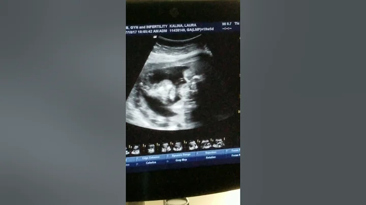 Baby kalina vid 3