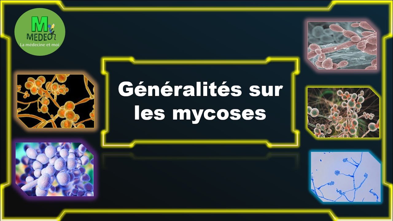 GENERALITE SUR LES MYCOSES: cours de parasitologie médicale - YouTube