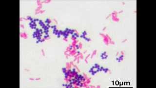 Microscopy and Gram staining