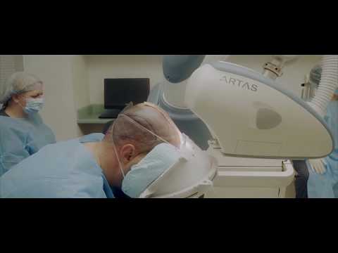 Robotic Hair Transplant Patient Recounts Experience at Bernstein Medical