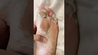 Viral foot mask🙌🏻😱😱#footmask
