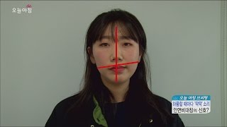 [Morning Show] Preventive exercise facial asymmetry 안면비대칭의 원인이 '턱관절 장애'!? [생방송 오늘 아침] 20160325