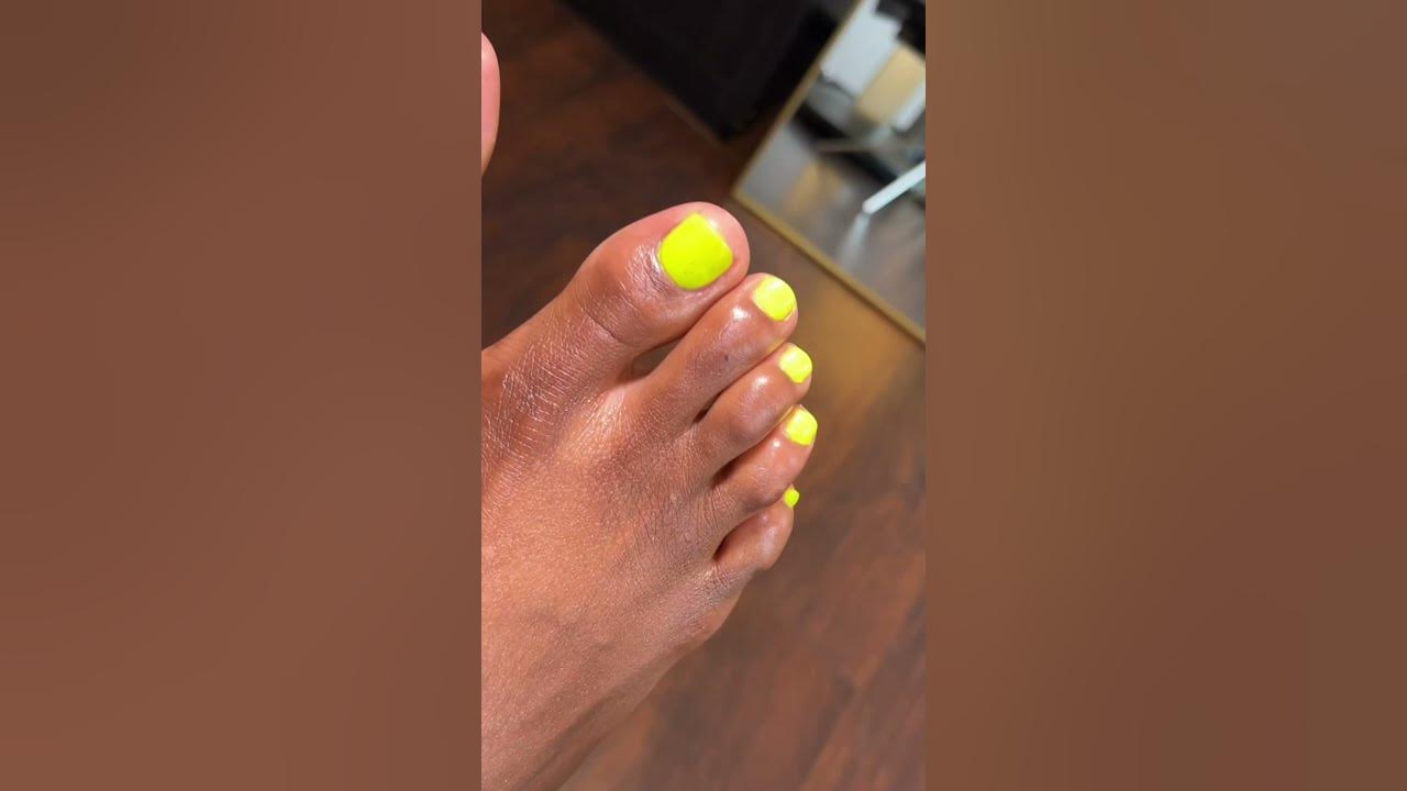 Scar camouflage for foot corns and discoloration foottattoo 