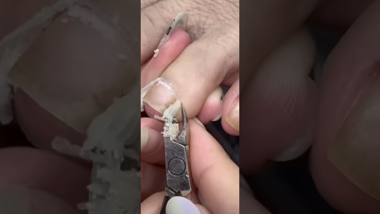 #nails #nailcare #pedicure