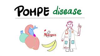 Pompe Disease (with a mnemonic) | Glycogen Storage Diseases